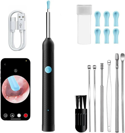 HD Ear Cleaning Camera – See & Remove Ear Wax Safely 👂