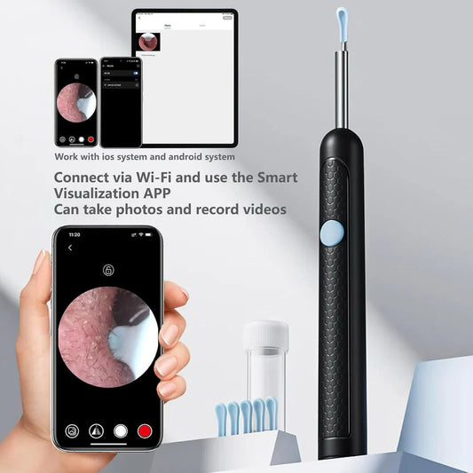 HD Ear Cleaning Camera – See & Remove Ear Wax Safely 👂