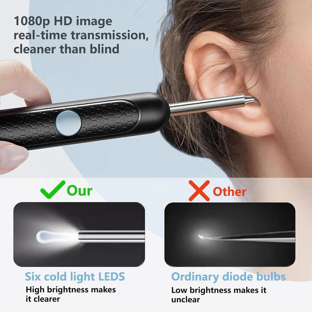 HD Ear Cleaning Camera – See & Remove Ear Wax Safely 👂